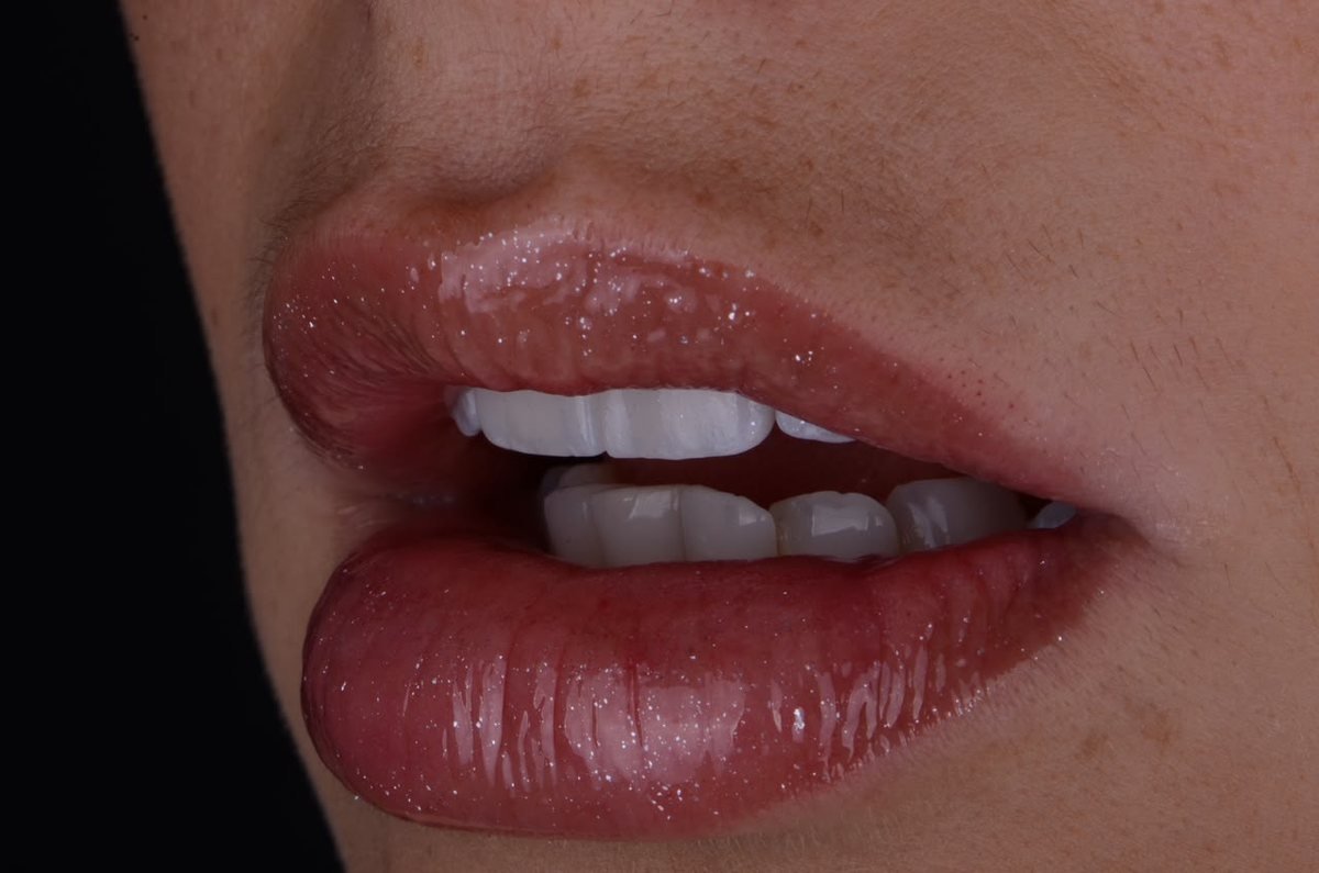 Detalhe de sorriso e lábios