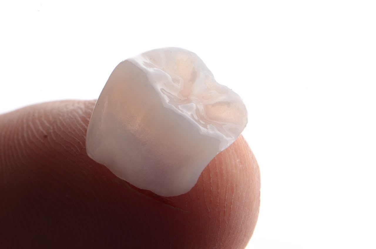 Faceta de porcelana em detalhe